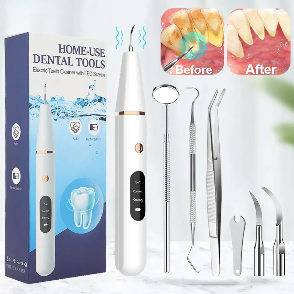 Teeth Whitening Before And After - Complete UK Guide