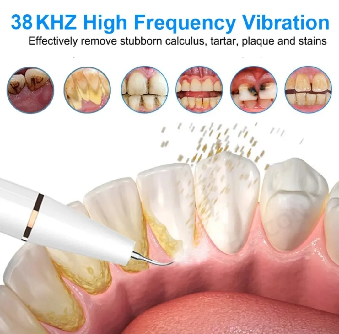 Side-by-side teeth whitening before and after comparison on a UK bathroom counter