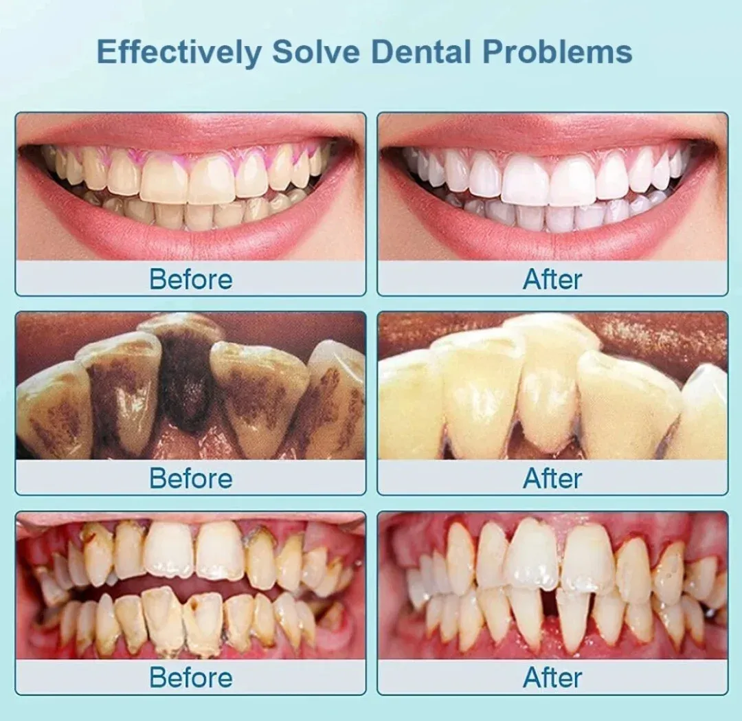 DPR Crelé product 1